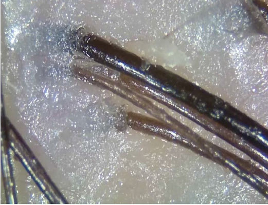 Портативный беспроводной прибор диагноза телемедицины анализатора кожи цифров с поляризовывает свет