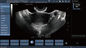 Трансвагинал блок развертки ультразвука Допплер цвета зонда, Хандхэльд беременность Допплер
