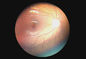 Офтальмическая камера Opthalmoscope Fundus цифров прибора с Diopter разрешения -20~+20D видео- 1280 x 960