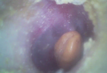 Otoscope цифров портативного ENT объема экономический Handheld видео- с микро- флэш-картой SD 32G