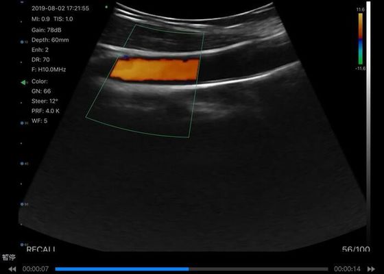 Цифровой беспроводный ультразвуковой сканер