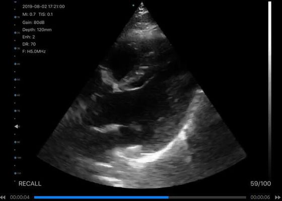Цифровой беспроводный ультразвуковой сканер