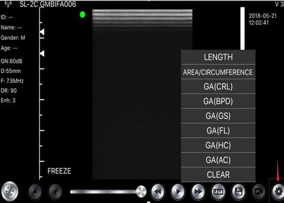 Handheld блок развертки ультразвука 5G выпуклый: 3.5~5MHz, линейное: 7.5~10MHz, сердечное: 2.5~5MHz