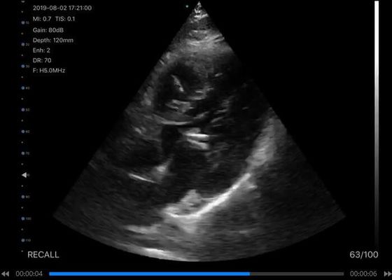 Handheld блок развертки ультразвука 5G выпуклый: 3.5~5MHz, линейное: 7.5~10MHz, сердечное: 2.5~5MHz