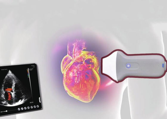 Элемент блока развертки 128 ультразвука PDI WiFi беспроводной портативный